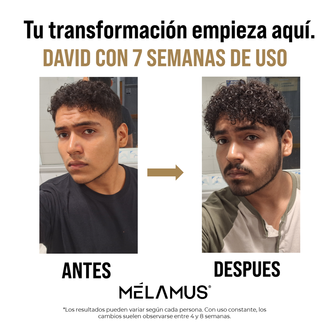 Bálsamo Mélamus - Minoxidil 20%